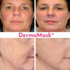 DERMA MASK™ + USDA Organic BUNDLE - Dermay