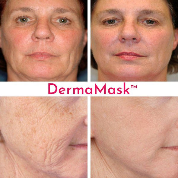DERMA MASK™ + USDA Organic BUNDLE - Dermay