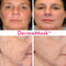 Load image into Gallery viewer, DERMA MASK™ + USDA Organic BUNDLE - Dermay

